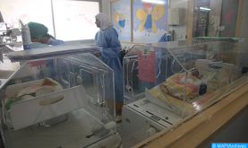 Rabat: Los gemelos siameses separados gozan de buena salud (médico)